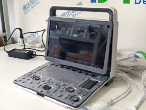 Échographe vétérinaire léger Zoncare M30, bonnes ventes, pour les centres d'imagerie vétérinaire - Product Image 4