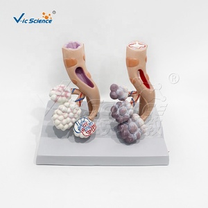 Modelo <span class=keywords><strong>de</strong></span> Comparación <span class=keywords><strong>de</strong></span> Pulmones: Pulmón Saludable vs. Pulmón <span class=keywords><strong>de</strong></span> <span class=keywords><strong>Fumador</strong></span> con Base, Herramienta Educativa para el Control del Tabaco - Product Image 3