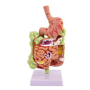 Modèle de simulation pédagogique de la pathologie du côlon humain, des maladies gastro-intestinales, des lésions du côlon, des maladies intestinales, des lésions du côlon - Product Image 1