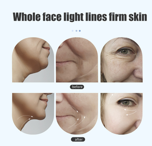 肌再生ハンドヘルドしわ除去器ABSスキンタイトニングデバイスネックフェイスリフティングデバイス工場 - Product Image 5