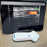 Escáner de Ultrasonido Inalámbrico Portátil EOMED CU120, Ultrasonido Facial, 1 Año de Garantía, Resistente al Agua IPX8, 3 Horas de Funcionamiento, Batería de 2200 mAh, 192