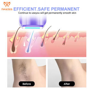 PAKISS Machine d'<span class=keywords><strong>épilation</strong></span> laser IPL portable avec flashs illimités Dispositif d'<span class=keywords><strong>épilation</strong></span> à <span class=keywords><strong>lumière</strong></span> <span class=keywords><strong>pulsée</strong></span> intense pour femmes et hommes - Product Image 3