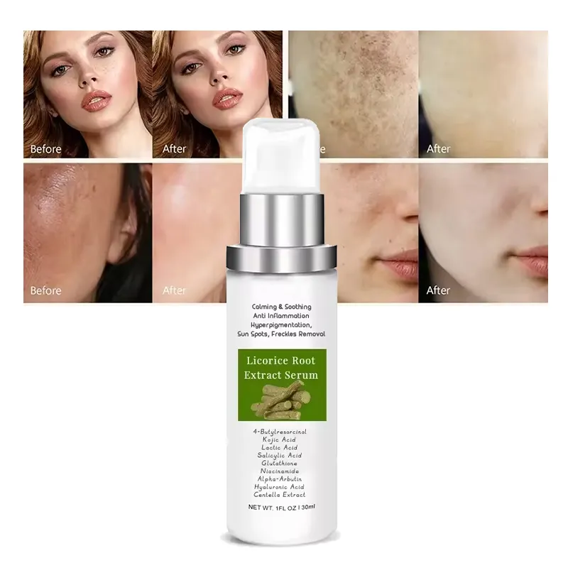 Entzündung hemmendes Süßholz wurzel serum für Dark Spot Corrector Sonnen flecken Sommersprossen entfernung Beruhigende beruhigende Essenz Gesichts seren