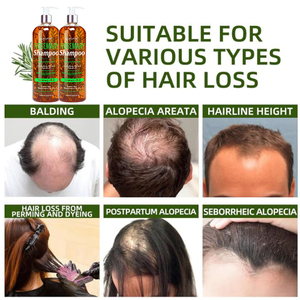 <span class=keywords><strong>Shampoo</strong></span> al Rosmarino Delicato per Pulizia Profonda, Nutrimento, Riparazione Cuticole, Lenitivo per il Cuoio Capelluto, Anti-Caduta - Product Image 4