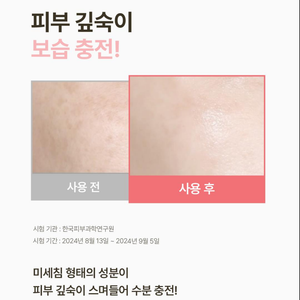 Crema para el Cuidado de la Piel Micro Needle Shot 300 de Marca Coreana con Colágeno para una Piel Más Elástica, Reducción de Sebo y Calmante - Product Image 5