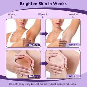 Crème éclaircissante pour <span class=keywords><strong>la</strong></span> <span class=keywords><strong>peau</strong></span> avec vitamine C pour les zones intimes, éliminateur de <span class=keywords><strong>taches</strong></span> brunes pour le corps, zones intimes sensibles, aisselles - Product Image 3