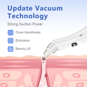 Aspirateur de points noirs, nettoyeur de <span class=keywords><strong>pores</strong></span>, 5 têtes d'aspiration, 3 niveaux, rechargeable, aspirateur facial <span class=keywords><strong>pour</strong></span> <span class=keywords><strong>nettoyer</strong></span> <span class=keywords><strong>les</strong></span> <span class=keywords><strong>pores</strong></span>, <span class=keywords><strong>appareil</strong></span> de nettoyage de la peau - Product Image 3