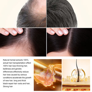 3000 100ml <b>Fast</b> <b>Hair</b> <b>Growth</b> <b>Oil</b> Repair <b>Hair</b> Scalp Care Anti <b>Hair</b> Loss Treatment Herbal Regrowth Thicken Serum Essence Liquid - Product Image 4