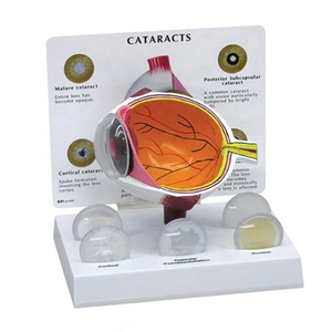Modelo Anatómico Educativo del Ojo Humano en 3D, 3 Partes, de Plástico, para la Enseñanza de Ciencias Médicas y Cataratas - Product Image 1