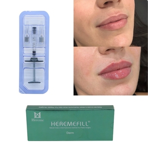 Acide hyaluronique réticulé, gel HA injectable pour <span class=keywords><strong>comblement</strong></span> et augmentation des lèvres, et traitement des <span class=keywords><strong>rides</strong></span> des lèvres - Product Image 4