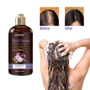 Private Label Onion Anti <strong>Hair</strong> Fall <strong>Oil</strong> and Shampoo Wellice <strong>Wow</strong> Red Onion Black Seed <strong>Oil</strong> Shampoo - Product Image 2