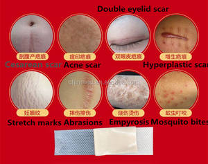 Cuscinetto cicatrice traspirante in Silicone per prodotti di consumo medicale C-Section e smagliature - Product Image 6