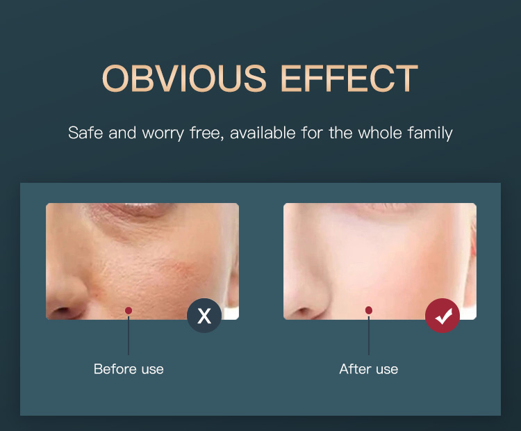 New 7 Color Skin Tightening Nano Spray Facial Panel Face Mask PDT LED Light Therapy Device With Steamer