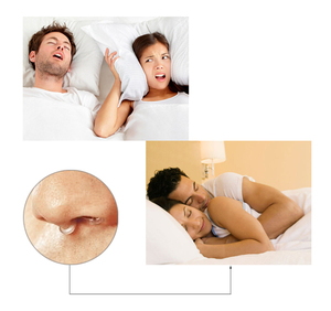 Dilatador Nasal Anti-Ronquidos y Protector Bucal, Solución para la Apnea del Sueño, 100% Silicona de Grado Alimenticio, Dispositivo de Cuidado de la Salud Ecológico - Product Image 4