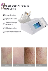 Equipo de Belleza Multifuncional para el Cuidado Facial, Limpieza Profunda de Poros, Antienvejecimiento, Radiofrecuencia, Reafirmación de la Piel, Crioterapia Calmante - Product Image 5