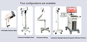 เครื่อง <span class=keywords><strong>colposcopy</strong></span> kernel KN 2200วิดีโอดิจิตอลสำหรับ <span class=keywords><strong>colposcopy</strong></span> เคอร์เนล KN - Product Image 6