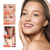 Crème Réparatrice Hydratante Bio Anti-Taches et Anti-Rousseurs à la Niacinamide de Marque Blanche pour Femmes Tous Types de Peau