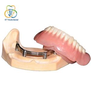 Implante Dental de Titanio Personalizado <span class=keywords><strong>CAD</strong></span> CAM de Fábrica, Accesorios para Implantes Dentales, Sistema de Restauración de Implantes, Implante Soportado - Product Image 1