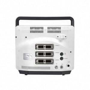 High-End Diagnostisch Systeem Sonoscape Doppler Ultrasone Machine Sonoscape E1 - Product Image 6