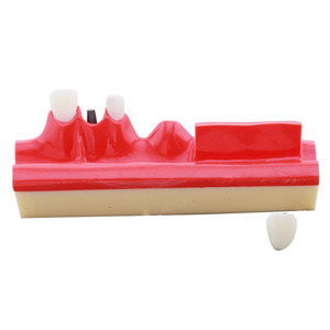 Modelo Dental Seccionado de Implantes, Material de Resina, Marca UMG con Certificación CE para Prácticas Estudiantiles - Product Image 6