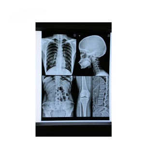 ブルーフィルムインクジェット<span class=keywords><strong>CR</strong></span> DR CTスキャン医療用ドライ画像X線フィルム放射線X線装置 - Product Image 6