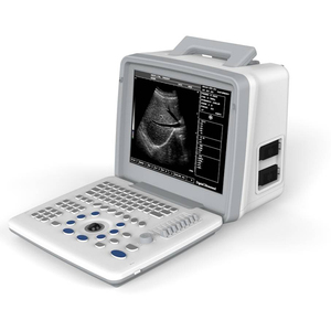 Thiết bị y tế LED xách tay máy siêu âm máy đầy đủ kỹ thuật số siêu âm hệ thống chẩn đoán - Product Image 3