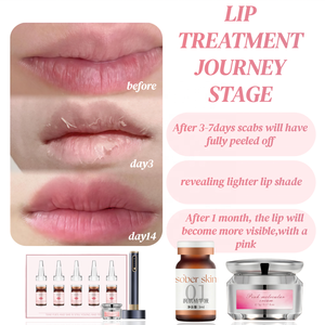 Sérum éclaircissant pour les lèvres avancé, cible la mélanine pour réduire efficacement les taches sombres, unifie le teint des lèvres roses - Product Image 4