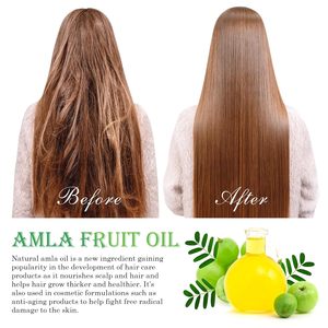 Olio per <span class=keywords><strong>Capelli</strong></span> all'<span class=keywords><strong>Amla</strong></span> all'Ingrosso, Olio Naturale di Uva Spina Indiana per Ispessimento e Nutrimento dei <span class=keywords><strong>Capelli</strong></span> Secchi e Danneggiati - Product Image 6