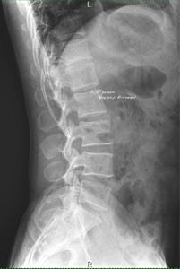 SY-D4343-1 kablosuz düz Panel dedektör kaset-boyut insan kullanımı için kablosuz taşınabilir düz Panel <span class=keywords><strong>X</strong></span> <span class=keywords><strong>ray</strong></span> dijital dedektör - Product Image 2