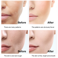 Ensemble de soins de la peau au peptide moléculaire de petite taille en 4 pièces, éclaircissant, raffermissant, nettoyant visage, essence, eau réparatrice, hydratant