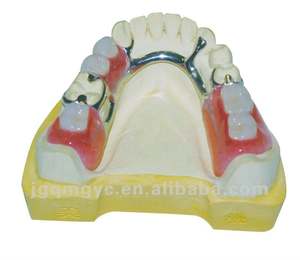 Prothèses dentaires amovibles avec cadre métallique imprimé <span class=keywords><strong>en</strong></span> 3D par laser, fabriquées <span class=keywords><strong>en</strong></span> Chine, laboratoire dentaire, <span class=keywords><strong>prix</strong></span> d'usine - Product Image 4