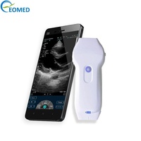 Sonda de Ultrasonido Inalámbrica Portátil de Alta Calidad EOMED, Doppler Color 3 en 1 (Fase/Lineal/Cardíaco), 128 Elementos, WiFi/USB