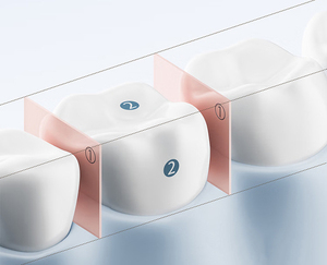 เครื่องฉีดน้ำแบบไร้สายพร้อมระบบกันน้ำ IPX7 และการควบคุม 3 โหมดสำหรับการเดินทางในบ้านใช้เครื่องมือทำความสะอาดช่องปากแบบพกพาแบบชาร์จไฟได้ - Product Image 3