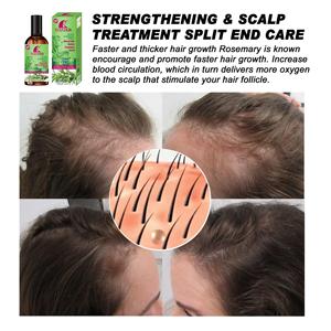 Organik biberiye nane derisi ve tüm saç tipleri için saç güçlendirilmesi uçucu yağ özelleştirilebilir özel etiket - Product Image 6