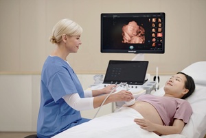 Échographe Doppler Couleur 3D/4D Professionnel SonoScape Propet 80 de Haute Qualité avec Logiciel Vétérinaire pour Hôpitaux et Cliniques - Product Image 5