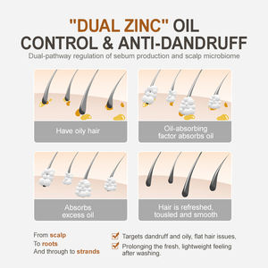 Champú de control de aceite anticaspa de etiqueta privada para cabello graso Fórmula personalizada para el cuidado del cabello por fabricante - Product Image 4