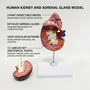 Modelo de Estructura Renal Humana con Glándula Adrenal, Espécimen de PVC para Entrenamiento en Laboratorio de Anatomía, <span class=keywords><strong>Nefrología</strong></span> <span class=keywords><strong>y</strong></span> <span class=keywords><strong>Urología</strong></span>, CE/ISO/ROHS/CNAS - Product Image 1