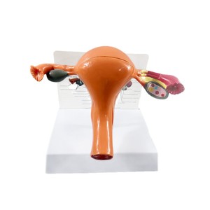 Modello Anatomico del Corpo Umano MAXCARE - Manichino Medico Vaginale, Ovarico e Uterino per l'Insegnamento dei Cambi Patologici in PVC - Product Image 5