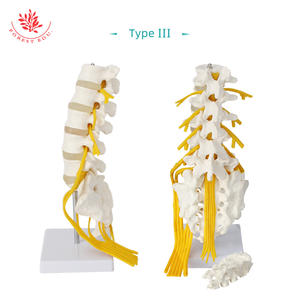 Modello di Vertebre Lombari a 5 Segmenti a Grandezza Naturale con Nervo Sacrale, Sacro Apribile, Dotato di Nervo Caudale Equino - Product Image 6