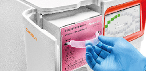 Automatische <span class=keywords><strong>Hba1c</strong></span> Analyzer Hplc Analyzer Medisch <span class=keywords><strong>Instrument</strong></span> Voor Klinische Diagnostiek - Product Image 4