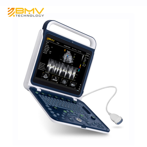 Mesin Diagnosis Portabel, Instrumen Troli Medis Ultrasound System Doppler Warna GYN Ultrasound