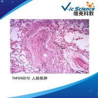 Medical Parasitology Prepared Slides Higher Education Microscope Slides