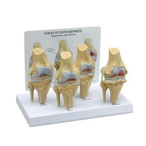 Modelo de Rodilla Humana con Simulación de PVC para Osteoartritis, Modelo Anatómico de <span class=keywords><strong>Esqueleto</strong></span> Médico - Product Image 1