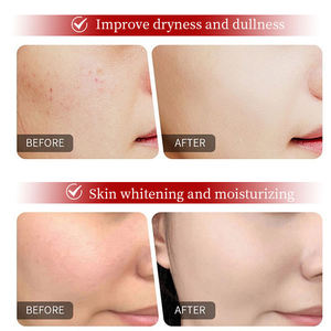 Suero Facial Blanqueador para Aclarar la Piel con Retinol, Ácido Hialurónico, Niacinamida, Vitamina C, Suero Facial Antienvejecimiento - Product Image 2