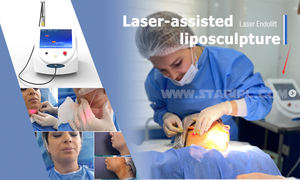 Endolaser Lifting du visage Lipolyse corporelle Liposuccion Vaser 30W 980nm Perte de poids au laser Dissolvant les graisses Injecter Dispositif de resserrement de la peau - Product Image 4