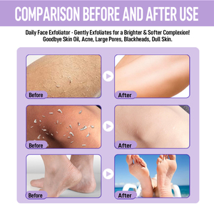 Gel exfoliant 2 en 1 à la papaye et aux raisins - Nettoyage en profondeur, éclaircissant, rafraîchissant, gommage pour le visage pour une peau éclatante 120g - Product Image 6