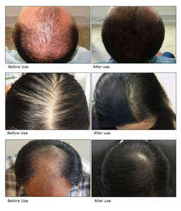 เซรั่มเร่งผมยาว 7 วัน ลดปัญหาผมร่วง สูตรออร์แกนิค ขิงและโรสแมรี่ กลิ่นหอมสดชื่นจากสมุนไพร 40 มล.  ลดราคาพิเศษ - Product Image 3