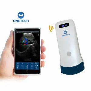 C38A Wifi Sonda tipo sonda abdominal sem fio mini ultrassom Doppler colorido para fins de Obstetrícia e Ginecologia