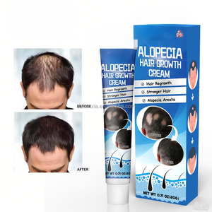 Suministro de Cuidado de la Salud Herbal Natural Crema en Gel Nutritiva para Engrosar el Cabello Cuidado del Cuero Cabelludo Ungüento para el Crecimiento del Cabello para la Alopecia - Product Image 3
