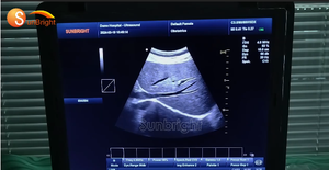 SUN-800F Appareil d'échographie 3D portable le plus vendu, instrument de diagnostic échographique PW CW pour usage humain - Product Image 5